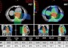 友芝友生物M701：恶性腹水治疗新突破，临床试验显示生存期显著延长