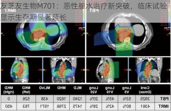 友芝友生物M701：恶性腹水治疗新突破，临床试验显示生存期显著延长