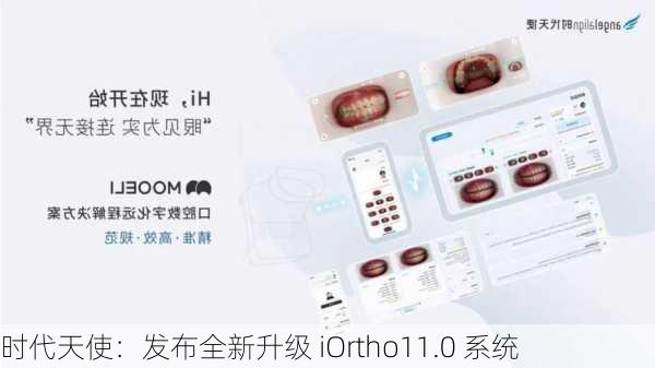 时代天使：发布全新升级 iOrtho11.0 系统