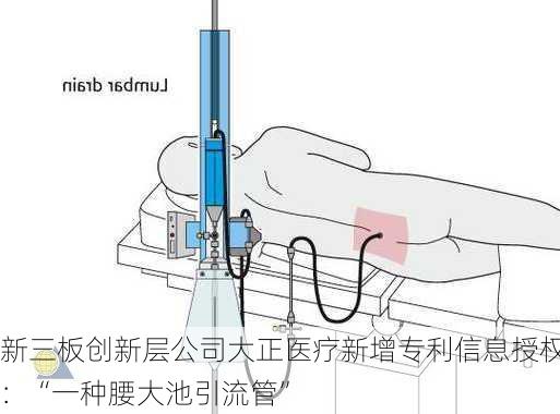 新三板创新层公司大正医疗新增专利信息授权：“一种腰大池引流管”